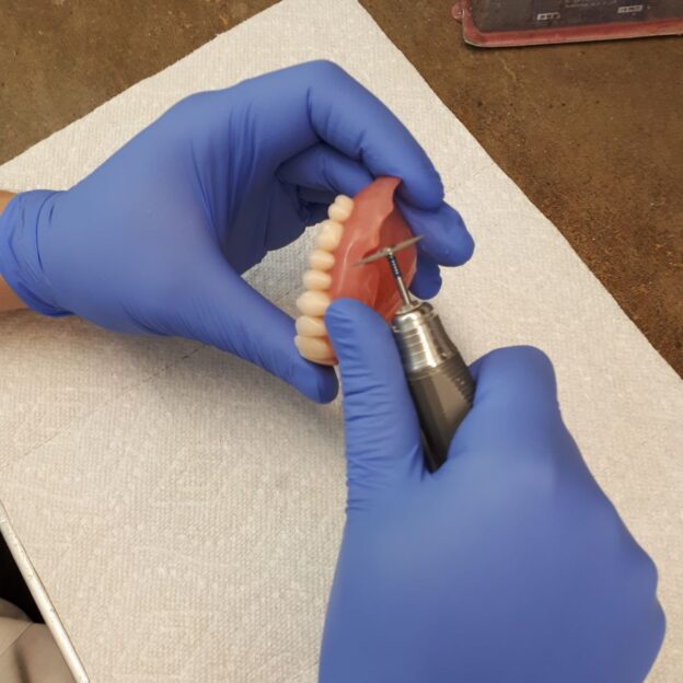 Denture Adjustments Shmitsman's Denture Clinic