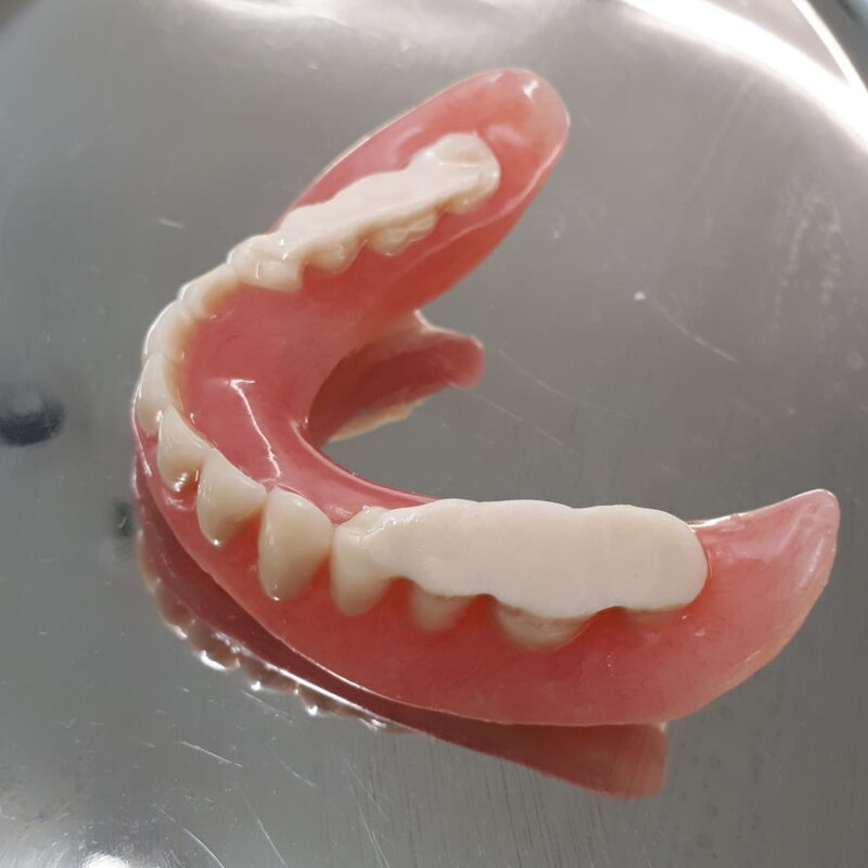 Transitional Teeth Therapeutic Dentures (transitional dentures) | Shmitsman's Denture Clinic