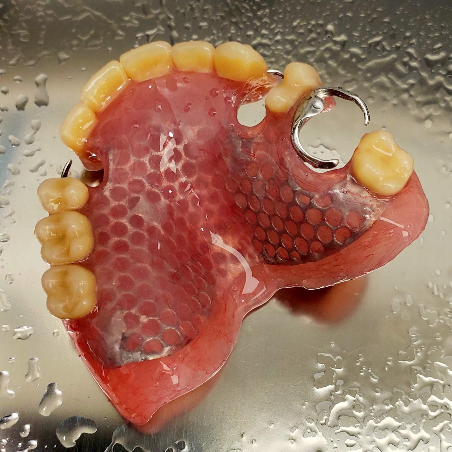 vancouver-denture-laboratory-67-1200