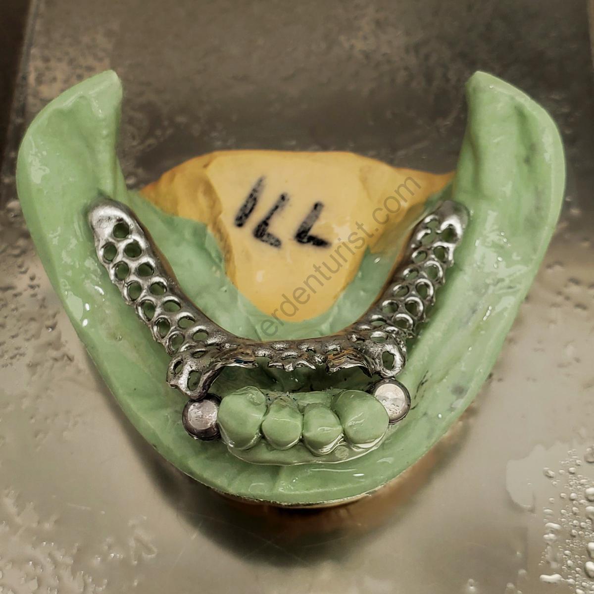 vancouver-denture-laboratory-76