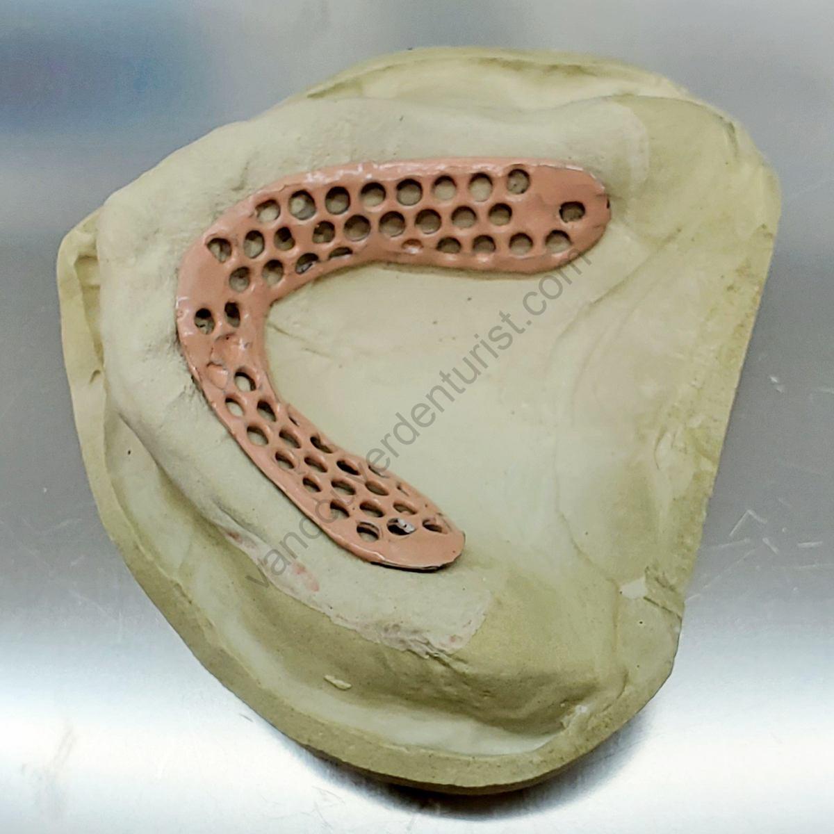 vancouver denture laboratory 77