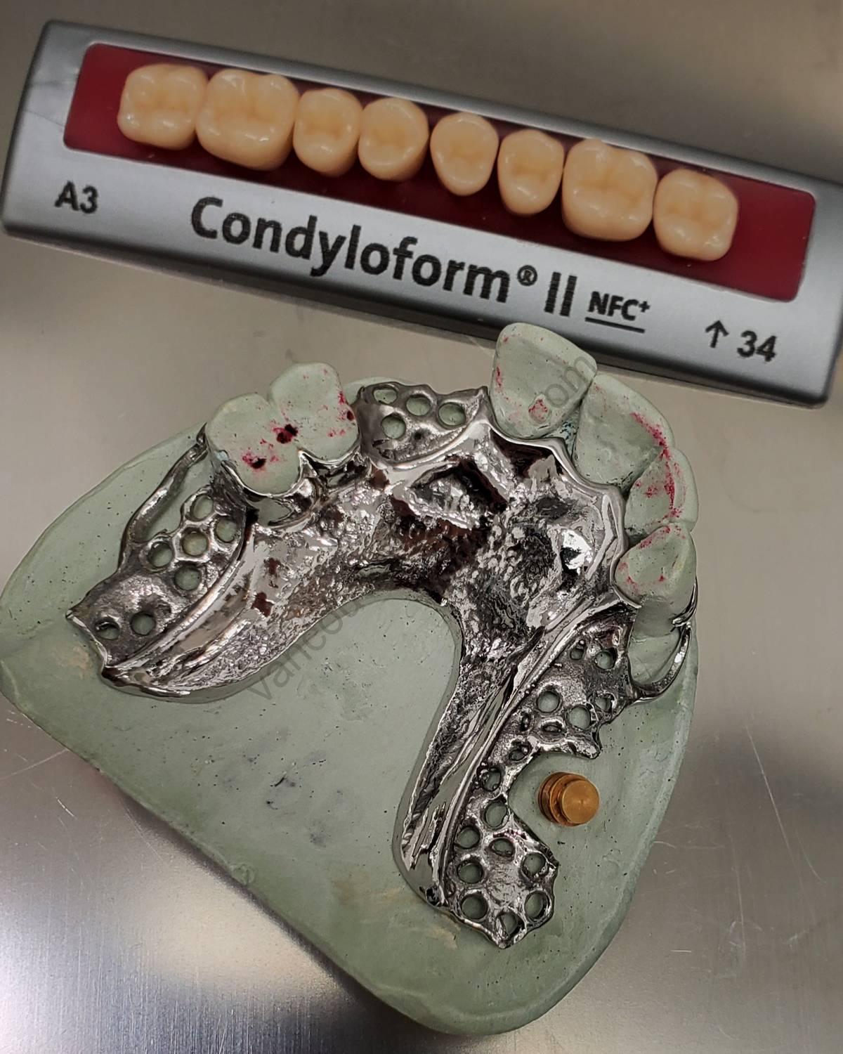 vancouver denture laboratory 78
